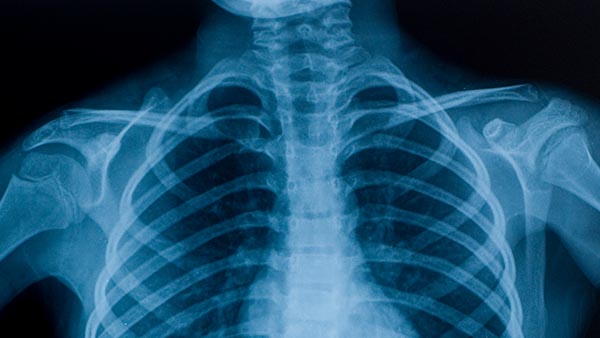 Radiology - Dragon Medical voice to text demonstration in Genie solutions